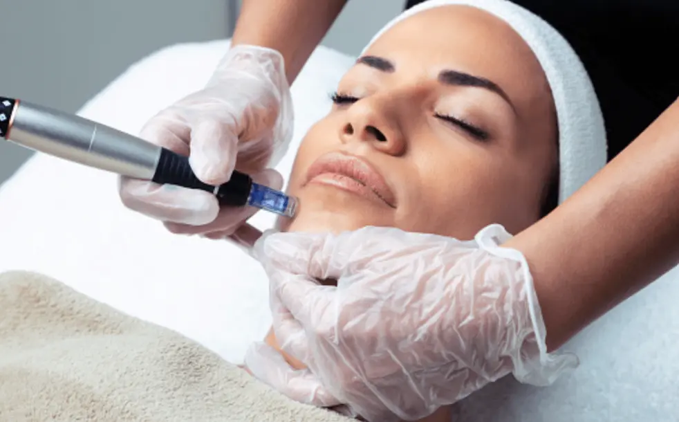 Dermapen Antiedad (Microneedling)