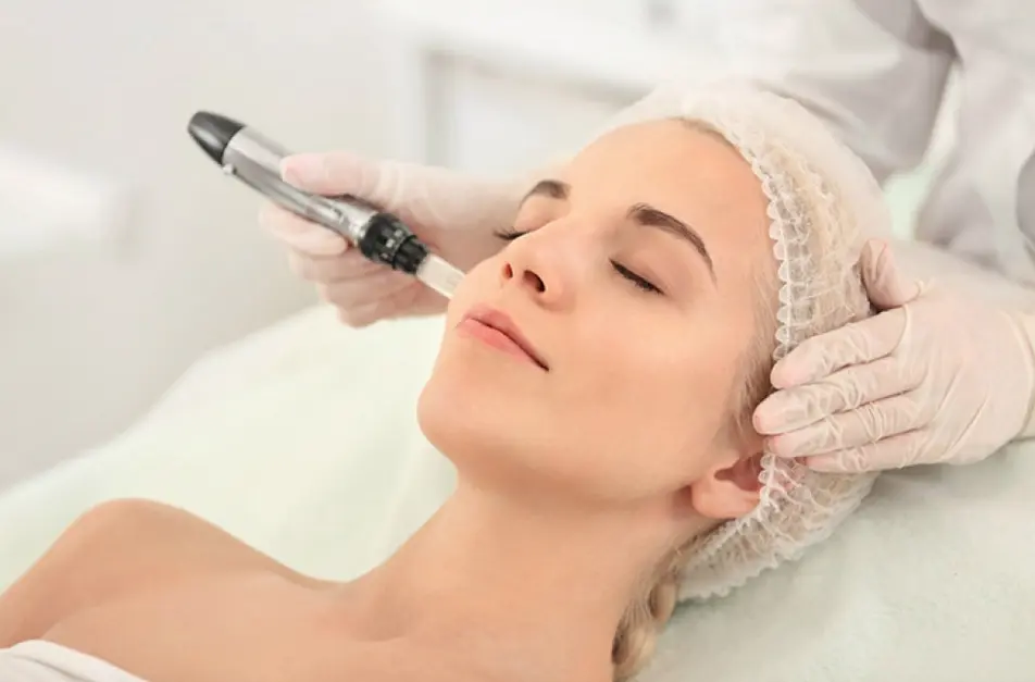 Dermapen Con Células Madres Desde