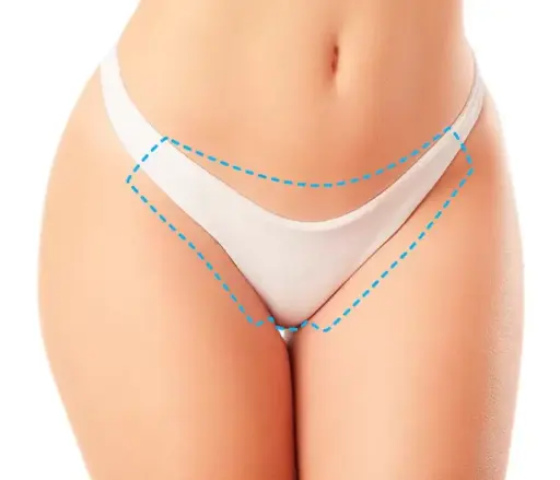 Bikini Brasileño